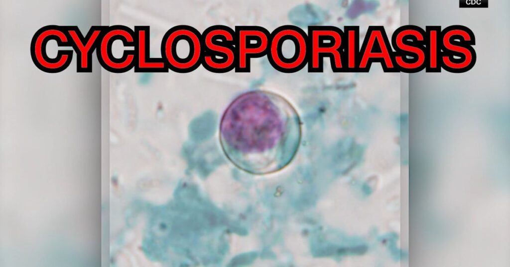 Cyclosporiasis outbreak: What you need to know Cyclosporiasis outbreak: What you need to know