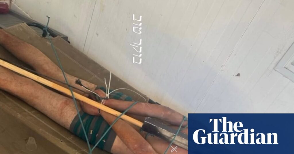 Photo of bound Palestinian detainee corroborates Israeli torture reports, say rights groups Photo of bound Palestinian detainee corroborates Israeli torture reports, say rights groups