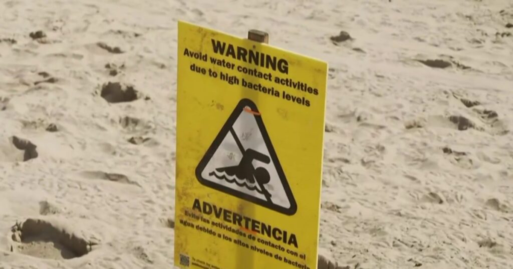 Bacteria shuts down beaches coast to coast in the U.S.