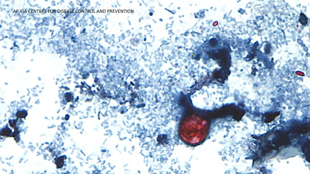 Outbreak of diarrhea caused by cyclosporiasis spreading in US with cases reported in CA, CDC says Outbreak of diarrhea caused by cyclosporiasis spreading in US with cases reported in CA, CDC says
