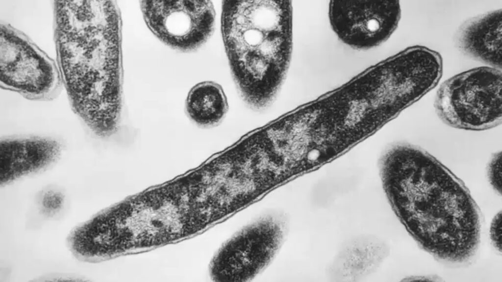 New York City health department says UES Legionnaires’ cluster exposure has ended New York City health department says UES Legionnaires' cluster exposure has ended