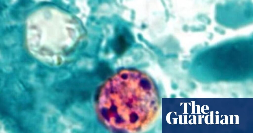 Former top US food safety official says Trump’s handling of cyclospora is ‘catastrophic’ Former top US food safety official says Trump’s handling of cyclospora is ‘catastrophic’