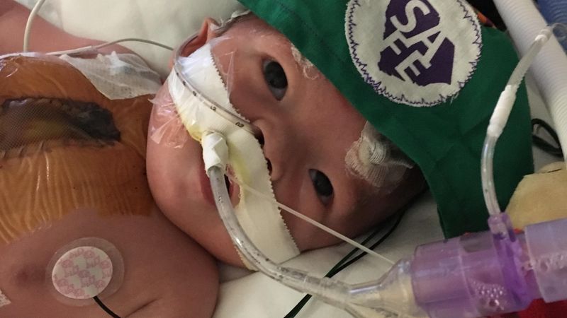 Ylvie after surgery (Provided)