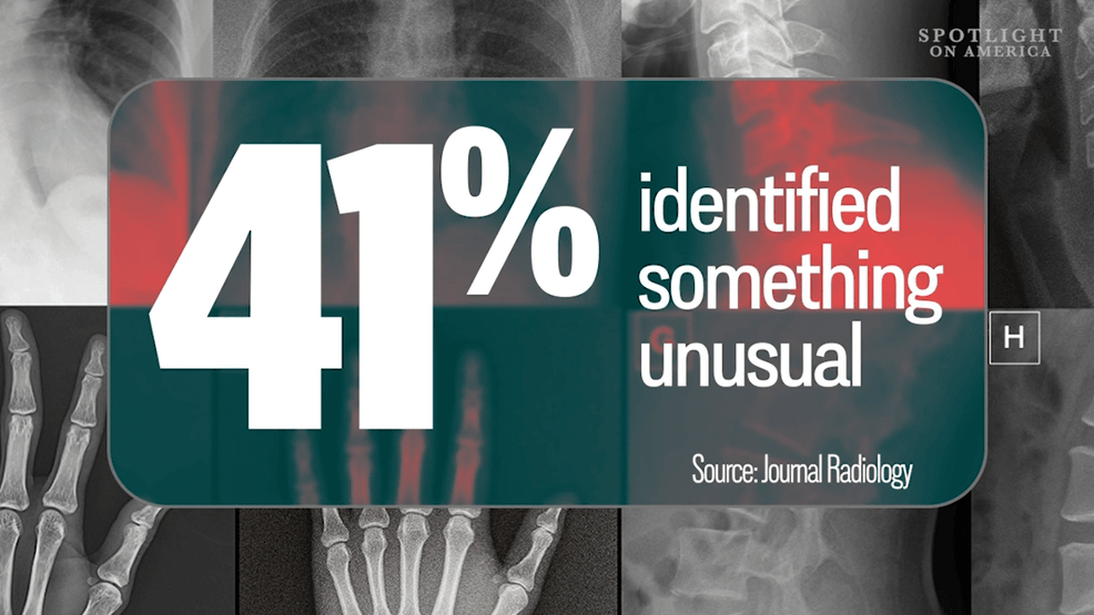 xray2.PNG
