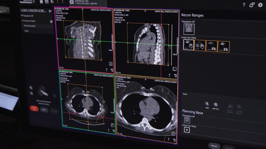 How AI and new tech are fighting the tri