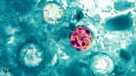 Cyclospora outbreak foods, what CDC data shows