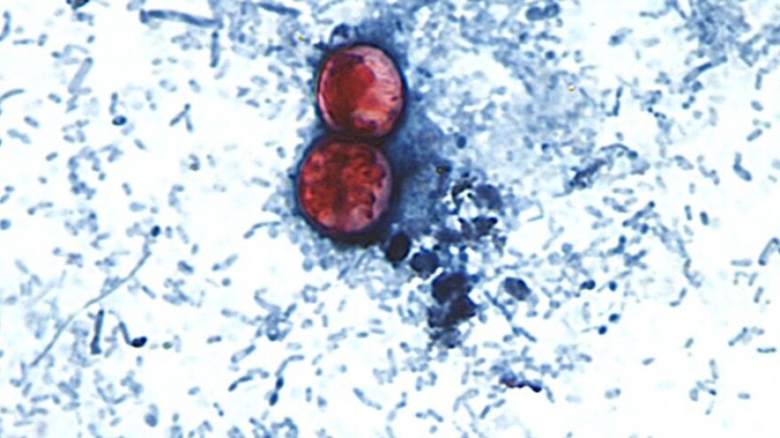 An image taken through a microscope shows Cyclospora cayetanensis oocysts found in a fresh stool sample which had been prepared with a formalin solution and stained with safranin.