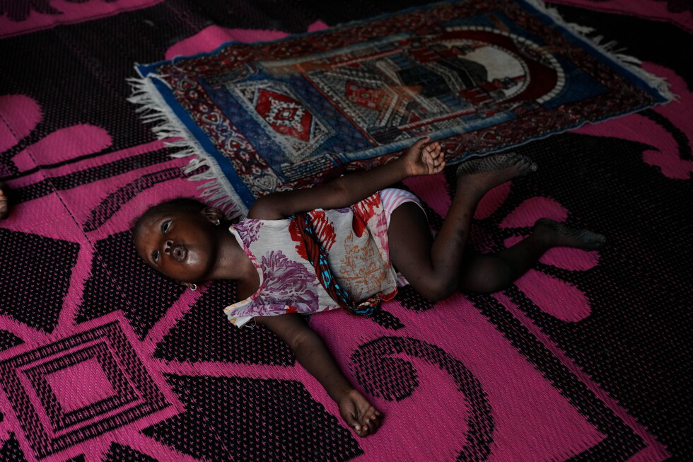 Nigerian children pay the price for the Iran war as malnutrition and poverty surge Nigerian children pay the price for the Iran war as malnutrition and poverty surge