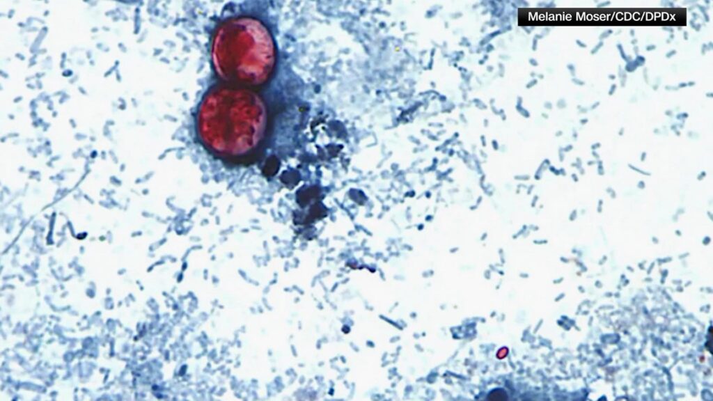 Parasite linked to contaminated food sickens 28 people in Westchester County Parasite linked to contaminated food sickens 28 people in Westchester County