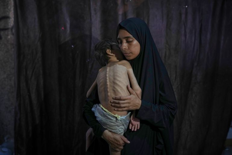 Samah Matar poses for a photo with her son Yousef, 6, who suffers from malnutrition and cerebral palsy, at a U.N.-run school in Gaza City, Saturday, July 26, 2025.