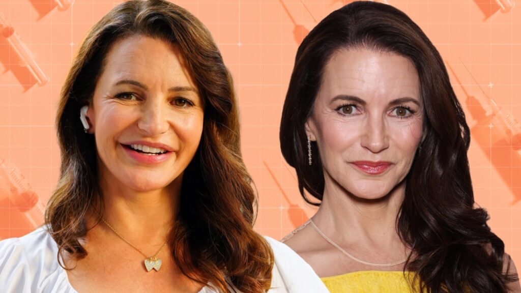 The Great Facial Filler Backlash: “It Got Carried Too Far” The Great Facial Filler Backlash: “It Got Carried Too Far”