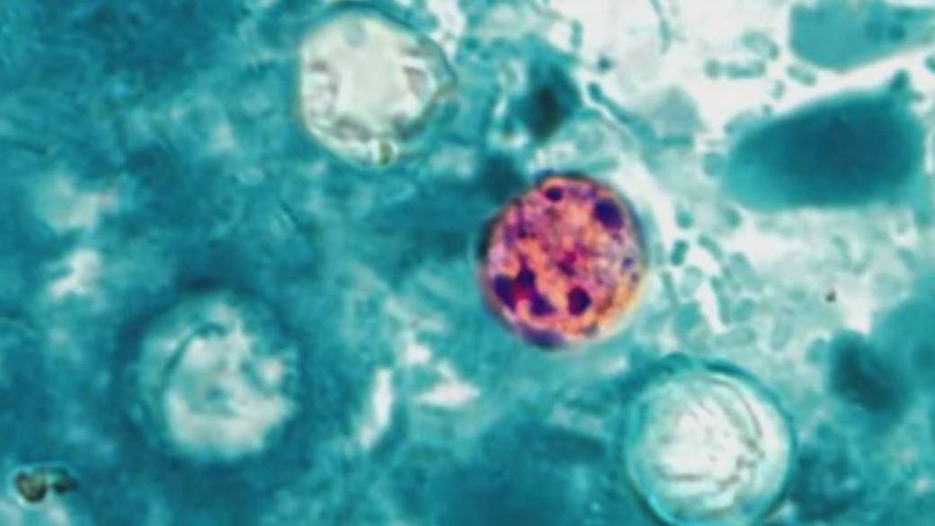 Click to play video: 'U.S. facing cyclospora outbreak causing diarrhea, nausea, and fatigue'