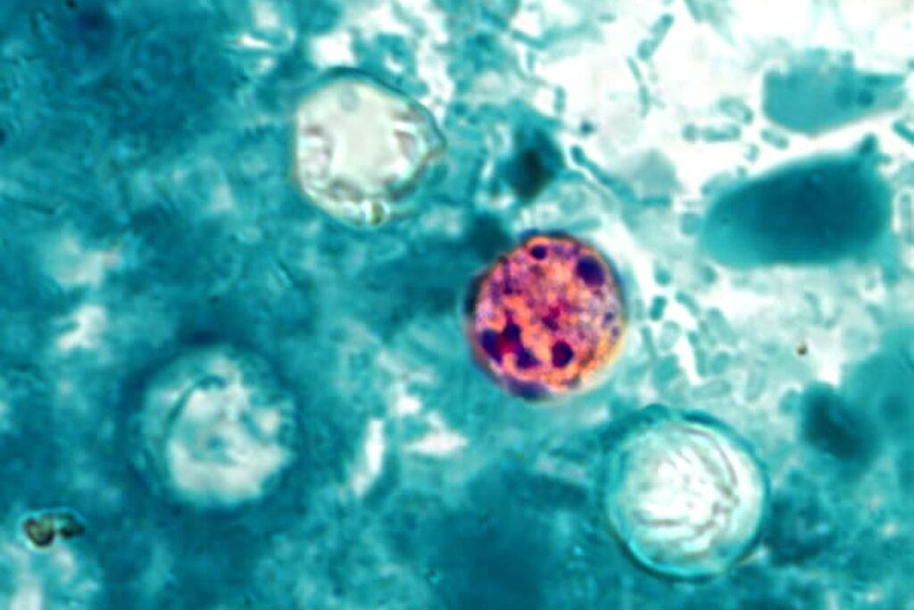 Maryland confirms nearly 150 cases of diarrhea-causing parasite Maryland confirms nearly 150 cases of diarrhea-causing parasite