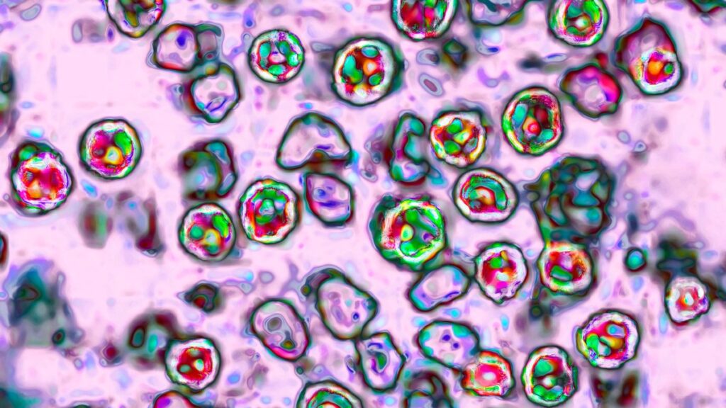 Health officials warn of measles exposure at PHL Airport on July 4th Health officials warn of measles exposure at PHL Airport on July 4th