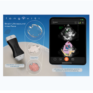 Longeviti Introduces Brain Ultrasound Interface Longeviti Introduces Brain Ultrasound Interface