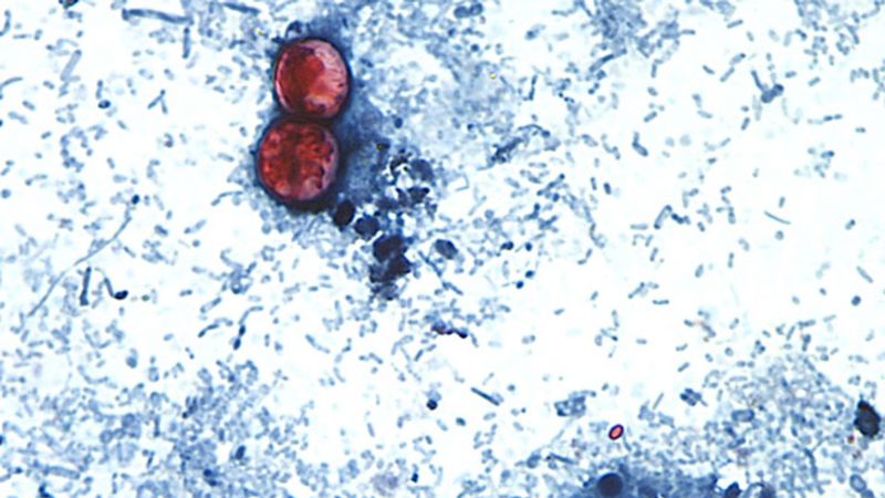 Massive cyclosporiasis outbreak linked to four more states Massive cyclosporiasis outbreak linked to four more states