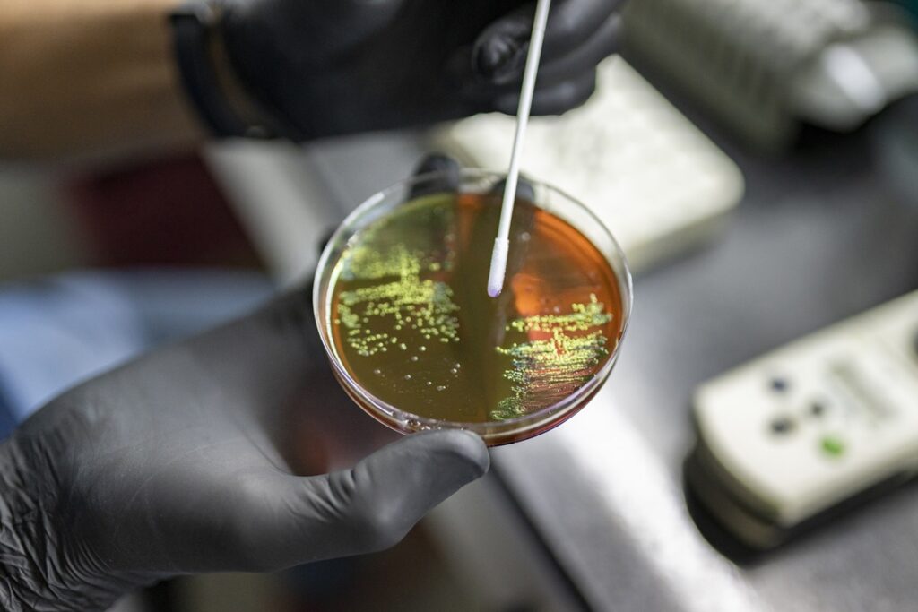 Antimicrobial resistance Antimicrobial resistance