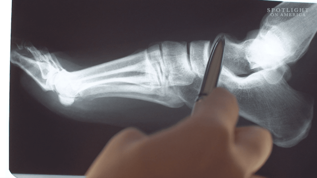 Even doctors can be fooled by deepfake X-ray images, posing cybersecurity & health risks Even doctors can be fooled by deepfake X-ray images, posing cybersecurity & health risks