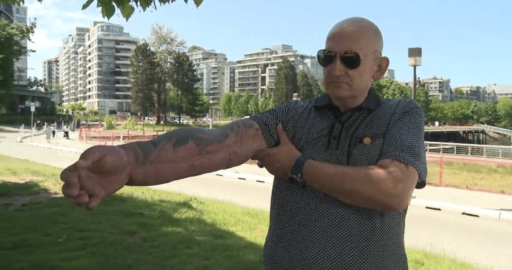 B.C. man still waiting for compensation from COVID vaccine injury B.C. man still waiting for compensation from COVID vaccine injury