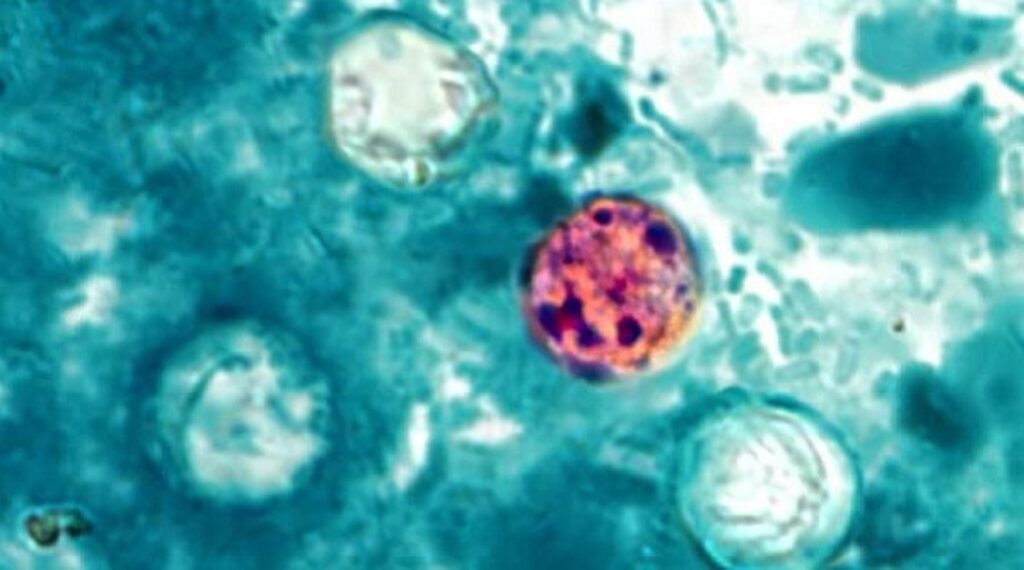 County Monitoring Shows No Local Cyclosporiasis Outbreaks, Food Safety Recommended County Monitoring Shows No Local Cyclosporiasis Outbreaks, Food Safety Recommended