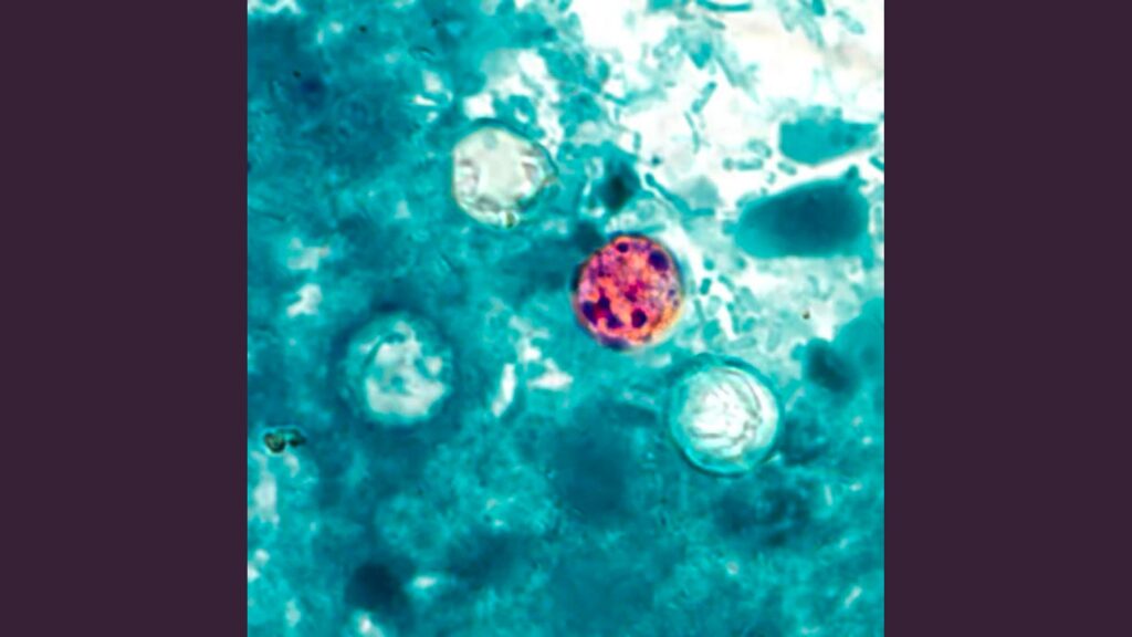 Cyclosporiasis outbreak: What to know | Harvard T.H. Chan School of Public Health Cyclosporiasis outbreak: What to know | Harvard T.H. Chan School of Public Health
