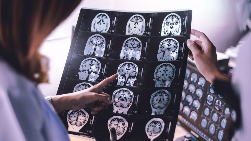 5 Recent Dementia Research Advances — From Blood Tests and Lithium to Lifestyle Changes 5 Recent Dementia Research Advances — From Blood Tests and Lithium to Lifestyle Changes