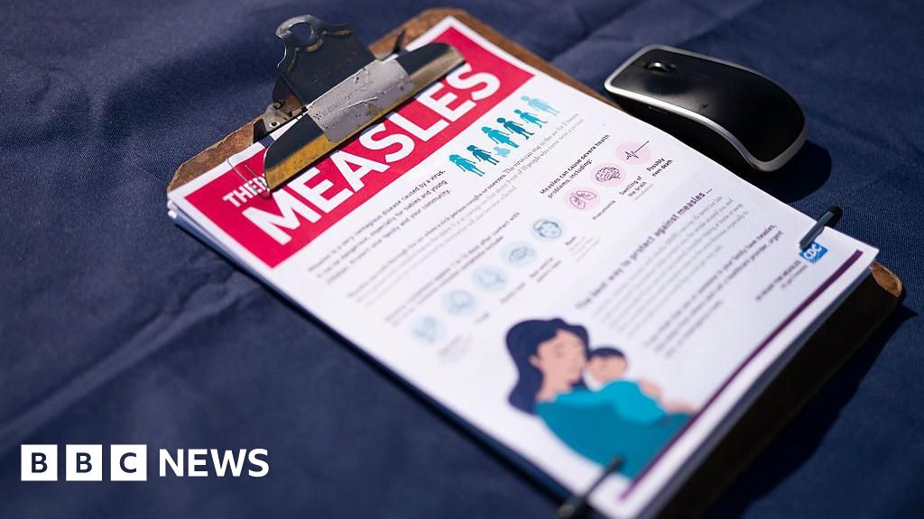 US sees highest number of measles cases in 35 years US sees highest number of measles cases in 35 years