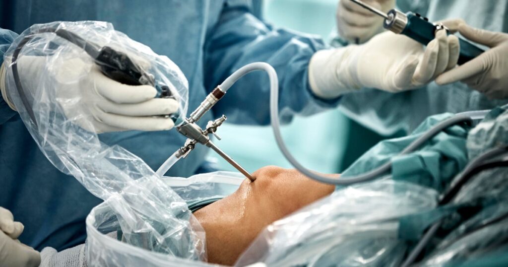 Common knee surgery may do more harm than good: "I don't know how I would defend this procedure"