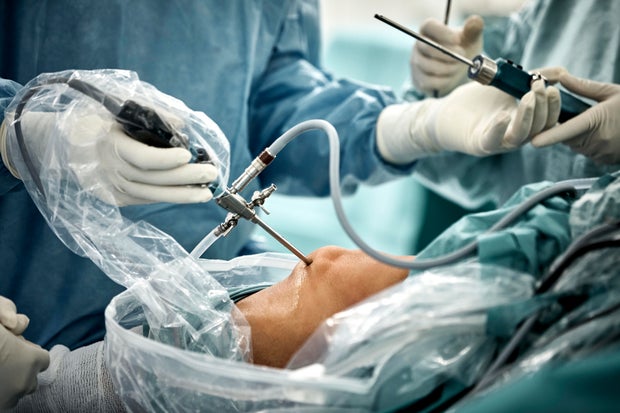 Close up of arthroscopic surgery on knee