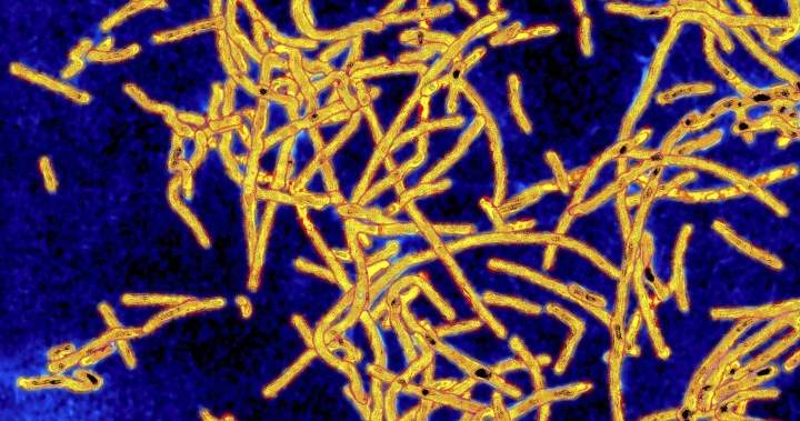 Legionnaires’ bacteria found in New York museum cooling systems: report – National Legionnaires’ bacteria found in New York museum cooling systems: report - National