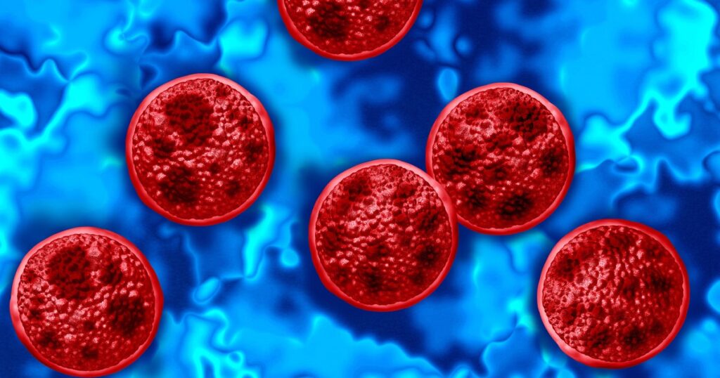 Michigan cyclosporiasis outbreak continues to spike, reaching 7,664 cases