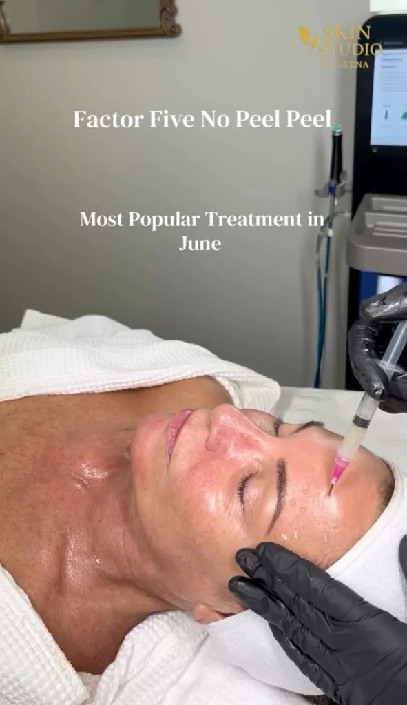 Sometimes she also gets Irena's Factor Five Chemical Peel, dubbed the "no-peel-peel," on her chest and hands. Instagram/skinstudiobyirena