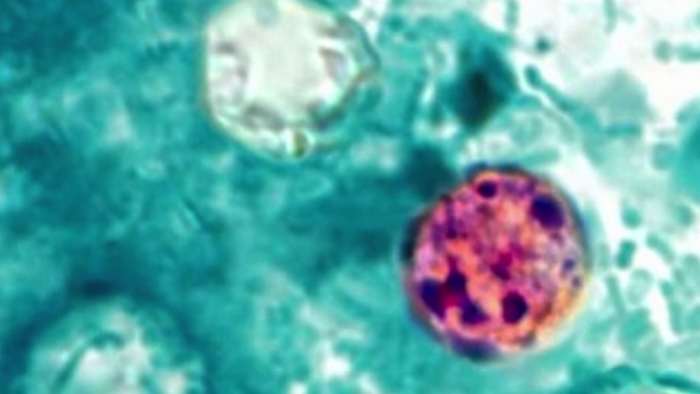 Michigan Cyclosporiasis outbreak tops 700 cases as health officials search for source Michigan Cyclosporiasis outbreak tops 700 cases as health officials search for source