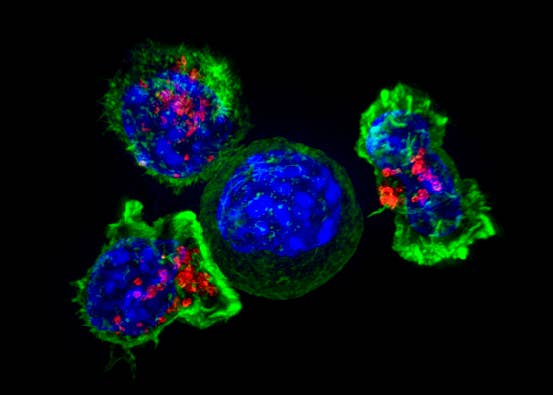 Killer T cells surround a cancer cell