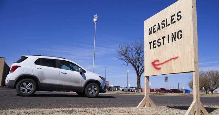 2026 U.S. measles cases have passed record-breaking tally for all of 2025 – National 2026 U.S. measles cases have passed record-breaking tally for all of 2025 - National