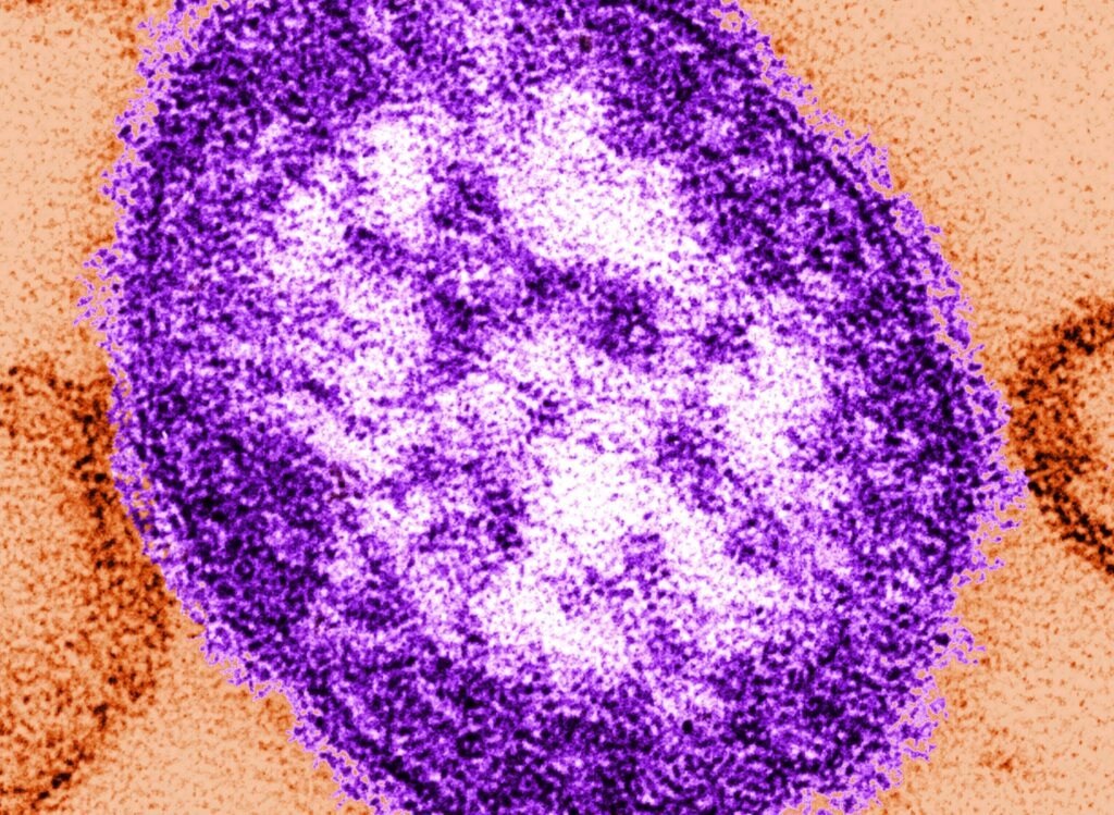 Delaware declares measles outbreak as cases quickly climb to 4