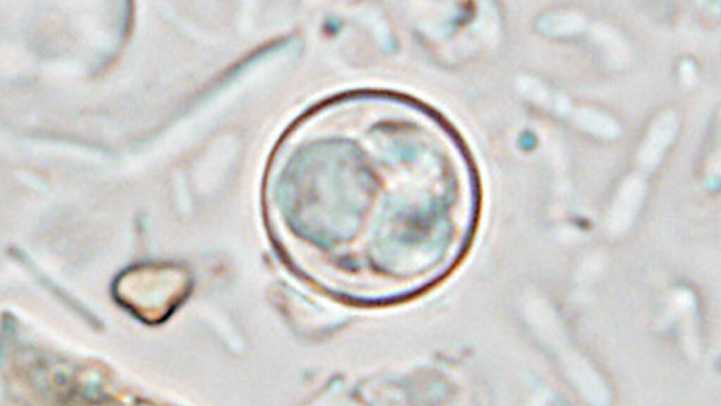 At least 9 cyclospora illnesses tied to NH hospital cafeteria food, officials say At least 9 cyclospora illnesses tied to NH hospital cafeteria food, officials say