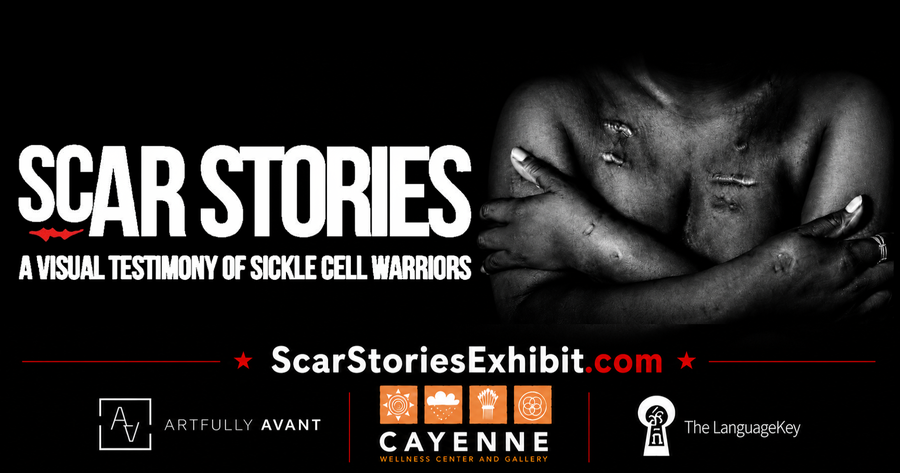 Cayenne Wellness Center to Debut Scar Stories Art Exhibit Cayenne Wellness Center to Debut Scar Stories Art Exhibit