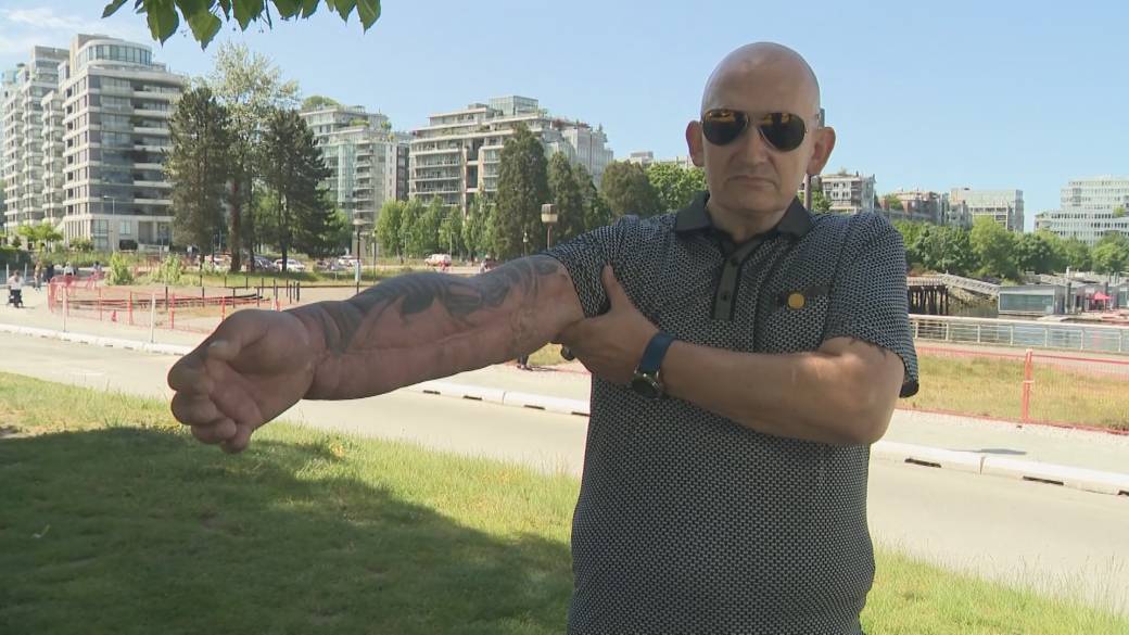 Click to play video: 'COVID-19 vaccine victim struggles to get compensation'