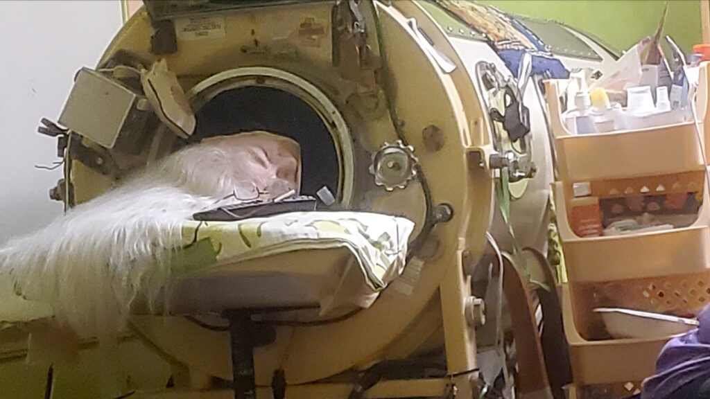 Martha Lillard, last US polio patient using iron lung, dies at 78 in Oklahoma Martha Lillard, last US polio patient using iron lung, dies at 78 in Oklahoma