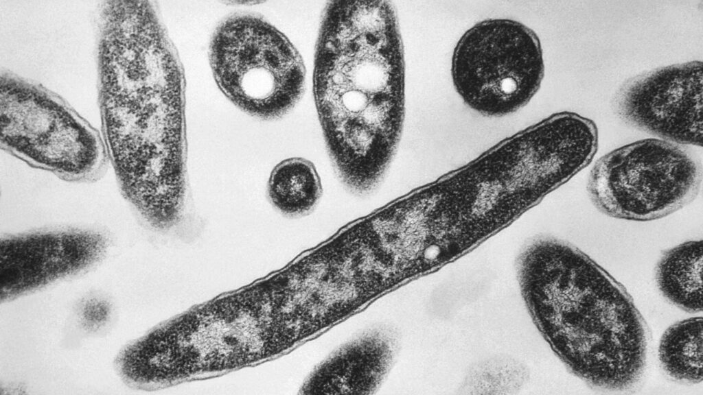 New diagnoses slow in NYC Legionnaires' disease outbreak; source still unclear