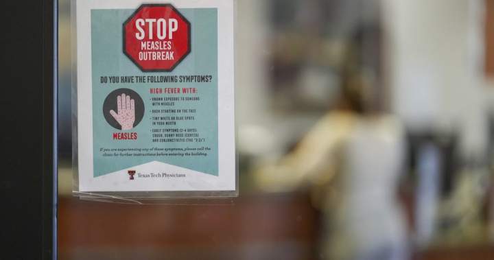 Canada’s measles cases are half of U.S. total, despite smaller population: WHO – National Canada’s measles cases are half of U.S. total, despite smaller population: WHO - National