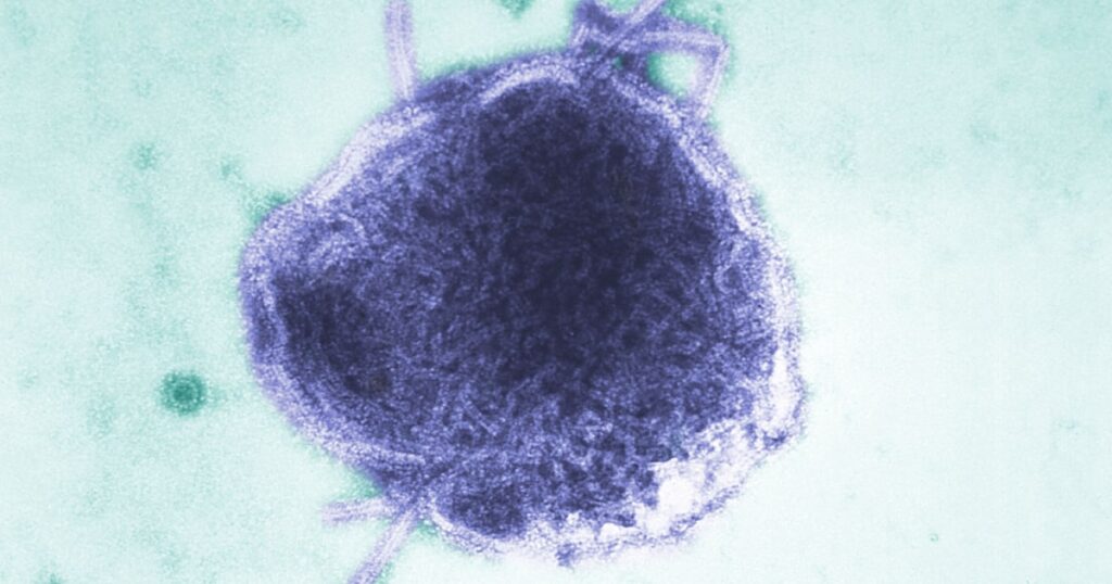Infant in Pennsylvania is one of two people reported to die of measles this week Infant in Pennsylvania is one of two people reported to die of measles this week