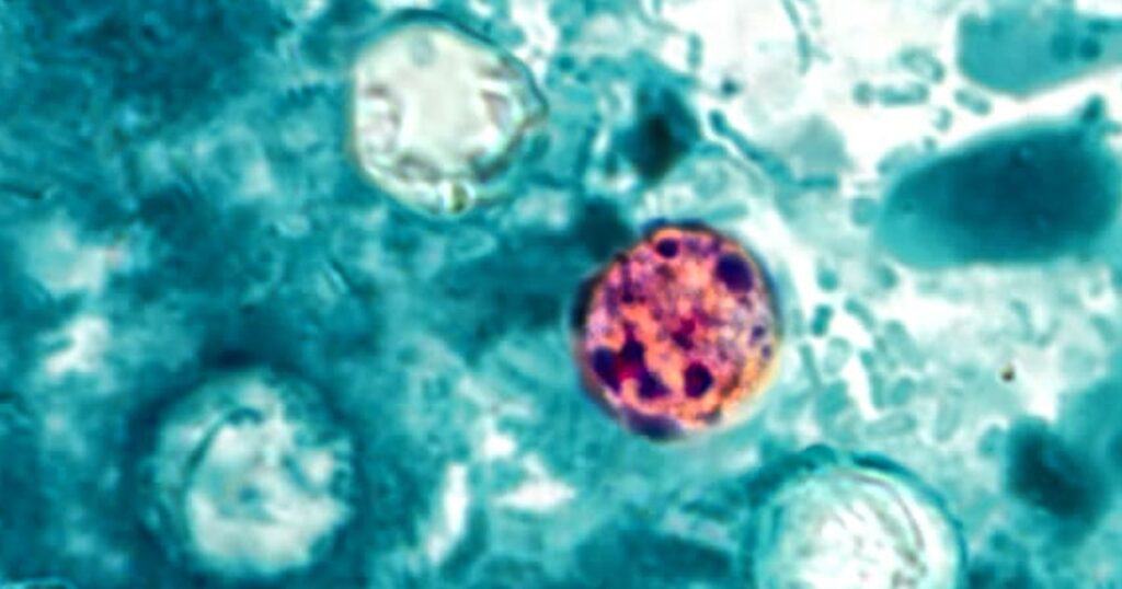 Michigan reports two deaths in cyclosporiasis outbreak Michigan reports two deaths in cyclosporiasis outbreak