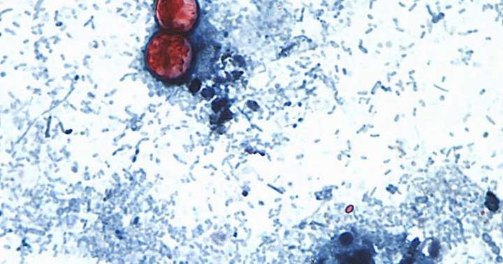 Michigan reports first U.S. deaths from multi-state cyclosporiasis outbreak – National Michigan reports first U.S. deaths from multi-state cyclosporiasis outbreak - National