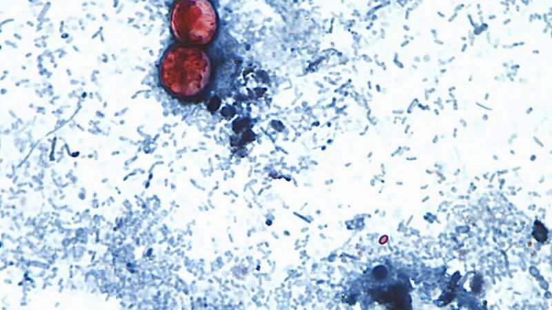FILE - This undated photo taken through a microscope provided by the CDC shows Cyclospora cayetanensis oocysts found in a fresh stool sample which had been prepared with a formalin solution and stained with safranin. (CDC via AP, File)