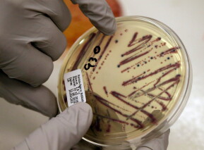 A microbiologist points out an isolated E. coli growth on an agar plate at the Washington State Department of Health, Nov. 3, 2015, in Shoreline, Wash. (AP Photo/Elaine Thompson, File)