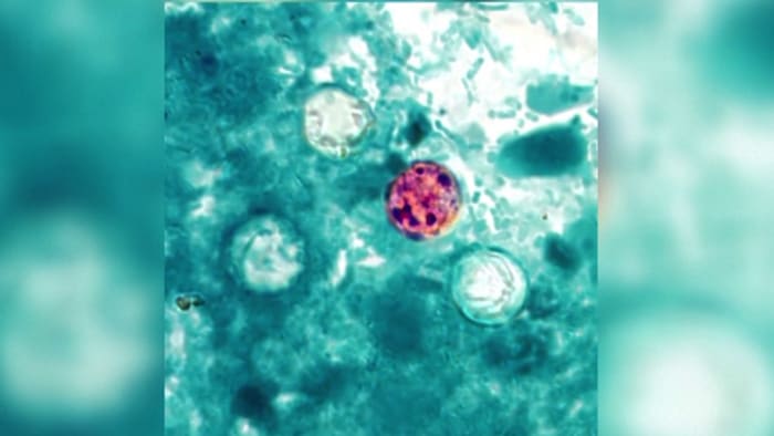 2 deaths in Michigan linked to cyclosporiasis outbreak as cases across the state exceed 11,000 2 deaths in Michigan linked to cyclosporiasis outbreak as cases across the state exceed 11,000