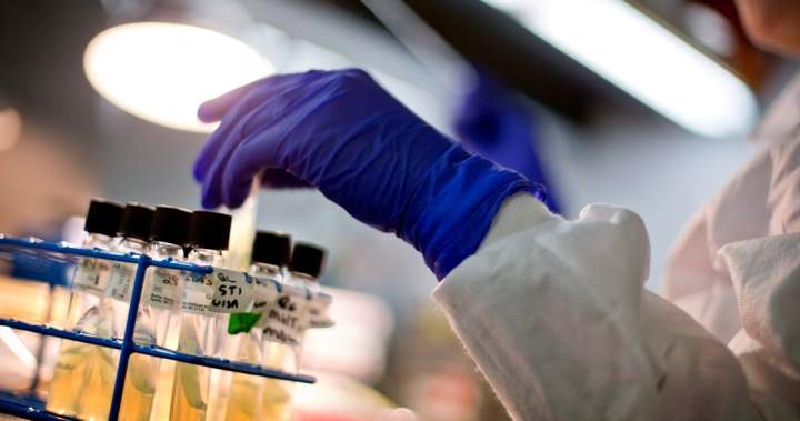 Stanford scientists just used AI to build a virus to target E. coli – National Stanford scientists just used AI to build a virus to target E. coli - National