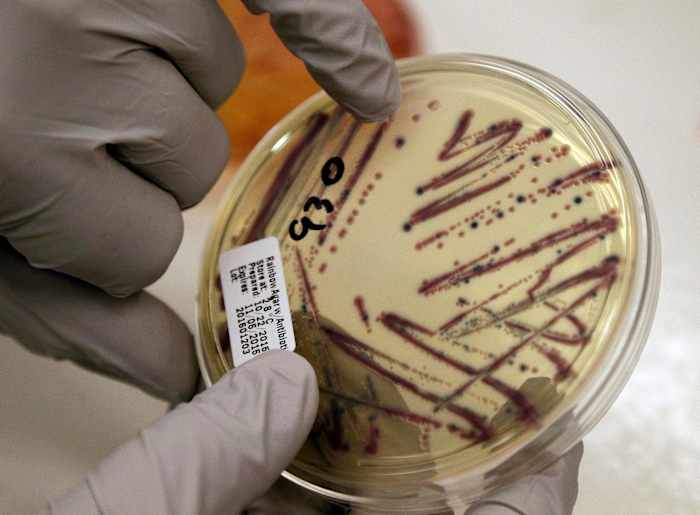 Alfalfa sprout linked to food-poisoning outbreak in 15 states, health officials say Alfalfa sprout linked to food-poisoning outbreak in 15 states, health officials say